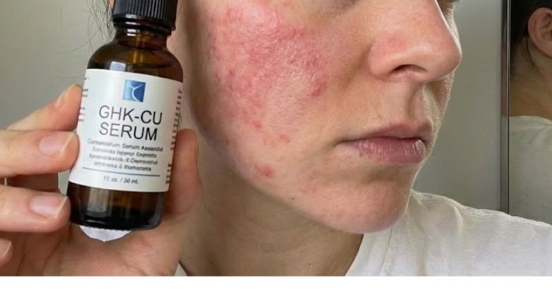 GHK Cu Peptide: What the Research Actually Shows and What It Doesn't