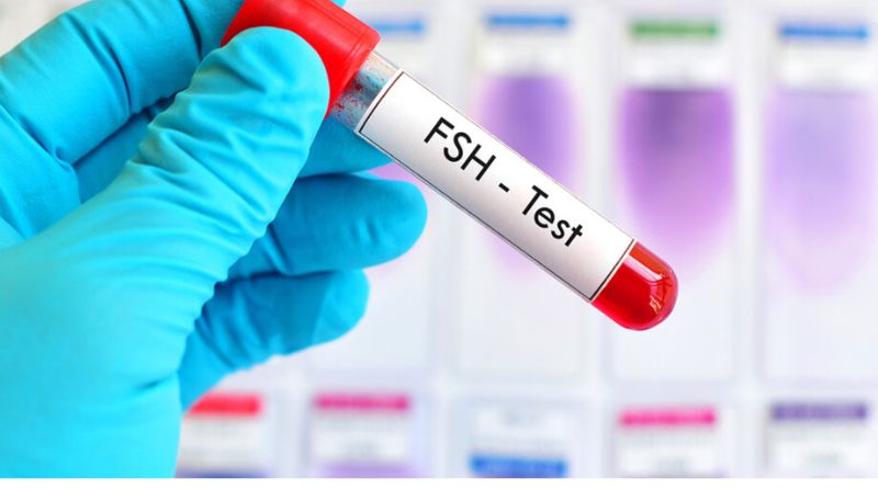 Normal FSH Levels by Age Chart